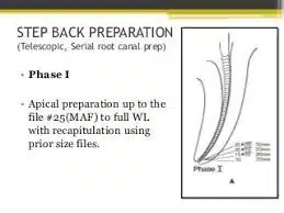 Endodontics: 6 Step Back Technique Steps With Diagram  Step Back Preparation