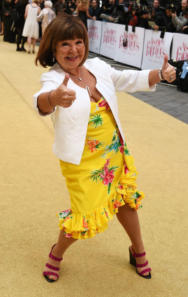 Top 10 Des Célébrités Atteintes Du Syndrome De Turner Janette Krankies - Top 10 Des Célébrités Atteintes Du Syndrome De Turner