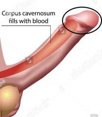 4 Weeks After Circumcision Pictures After Circumcision Picture