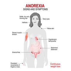Anorexia Nervosa: Causes, Symptoms And Treatments Anorexia Nervosa
