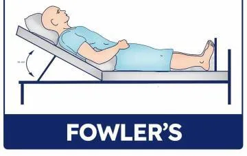 Fowler’s Position | Definition, Types, And Uses Fowler'S Position - Healthsoothe