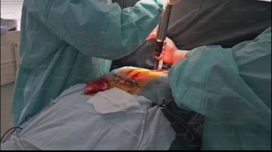 How Much Does A Gastric Bypass Cost? How Much Does A Gastric Bypass Cost?