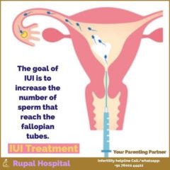The Cost Of Iui In Nigeria This Year: All You Need To Know Cost Of Iui In Nigeria