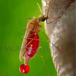 Malaria Fever, Causes, Prevention, And Treatment Malaria Fever