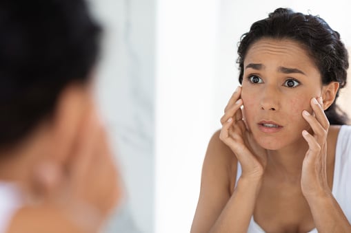 What To Do About Dark Spots Developing On Your Face What To Do About Dark Spots Developing On Your Face