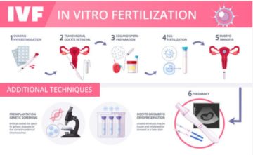 Cost Of Ivf In Nigeria This Year: All You Need To Know Cost Of Ivf In Nigeria