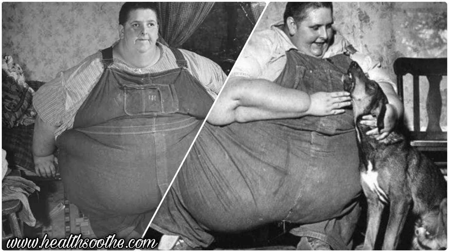 An Insight Into The Life Of Jon Brower Minnoch: The Fattest Person In The World To Have Ever Lived Jon-Brower-Minnoch.jpg The Fattest Person In The World