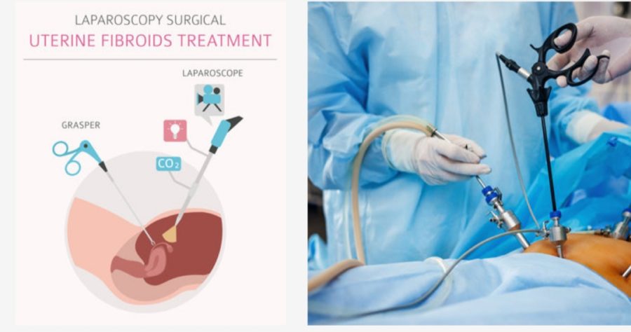 Cost Of Laparoscopy In Nigeria : All You Need To Know Cost Of Laparoscopy In Nigeria