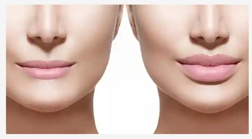 Your Most Popular Lip Fillers Questions, Answered Your Most Popular Lip Fillers Questions, Answered