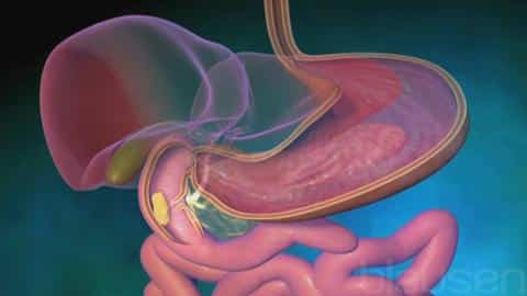 7 Nigerian Foods For Ulcer Patients Nigerian Foods For Ulcer Patients