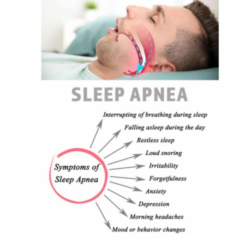How To Cure Sleep Apnea Naturally At Home Without Cpap? How To Cure Sleep Apnea Naturally At Home Without Cpap?