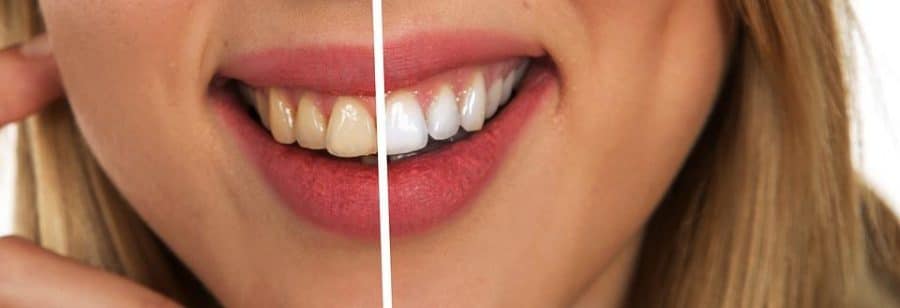 8 Oral Hygiene Tips For Healthy, White Teeth 8 Oral Hygiene Tips For Healthy, White Teeth