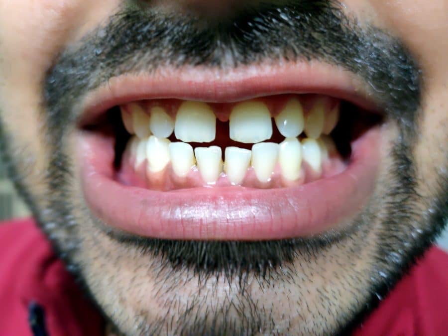 4 Best Ways To Keep Your Teeth In Perfect Health 4 Best Ways To Keep Your Teeth In Perfect Health
