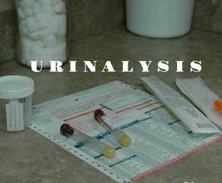 Understanding Urinalysis Tests And Urine In The Laboratory Understanding Urinalysis Tests And Urine In The Laboratory