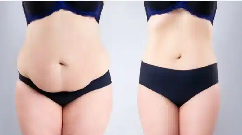 Weight Loss Methods And Health Benefits Seven Ways To Change Your Diet After Weight Loss Surgery