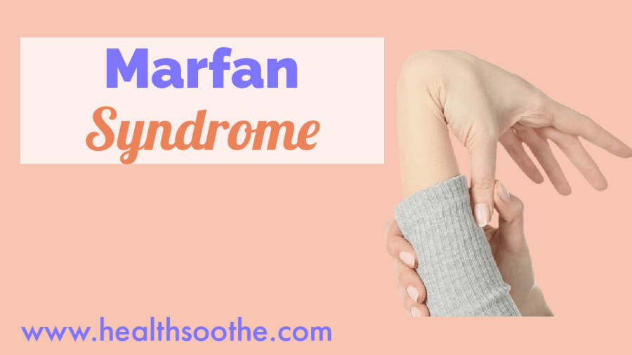 Top 13 Famous People With Marfan Syndrome You Didn’t Know About Marfan Syndrome