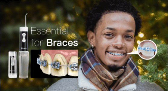 How To Improve Oral Hygiene With Braces? How To Improve Oral Hygiene With Braces