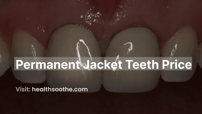 Exploring The Price Of Permanent Jacket Teeth: A Comprehensive Guide Permanent Jacket Teeth Price