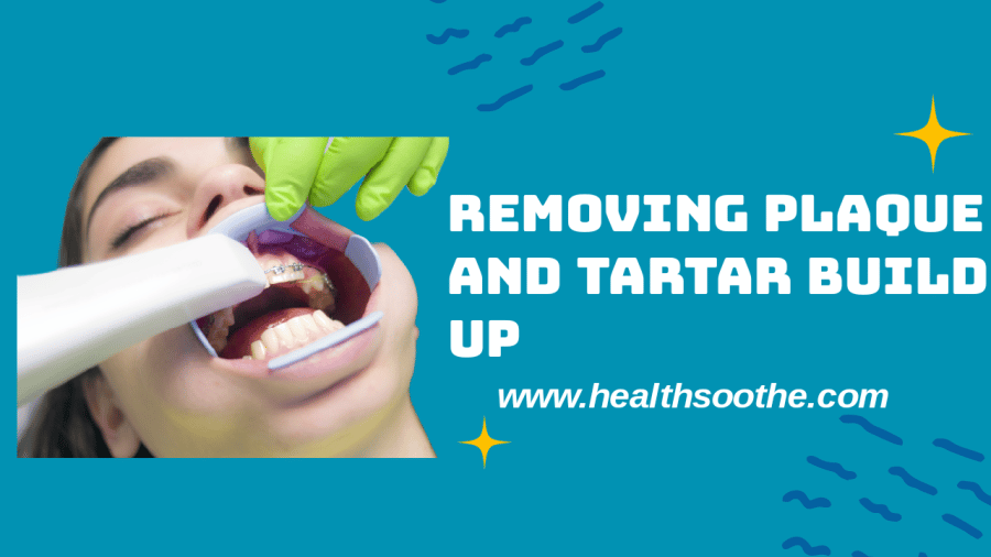Effective Ways Of Removing Plaque And Tartar From Your Teeth Naturally Plaque-And-Tartar