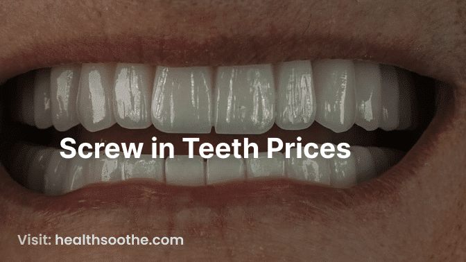 Understanding Screw-In Teeth Prices: A Comprehensive Guide Screw In Teeth Prices