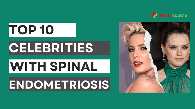 Top 10 Celebrities With Endometriosis Top 10 Celebrities With Endometriosis