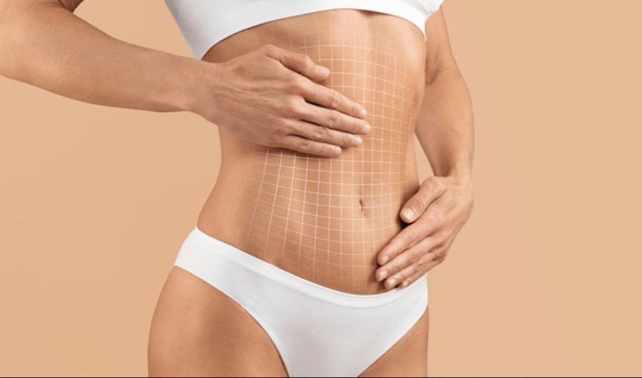 Your Guide To A Tummy Tuck: Before, During, And After Your Guide To A Tummy Tuck: Before, During, And After